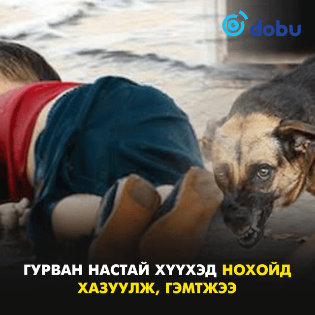 Бага насны хүүхэд нохойд хазуулж, гэмтжээ