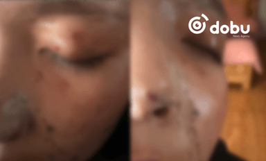 ЦЕГ: 9, 11-р ангийн сурагчид хоорондоо маргалдаж, нэгнийхээ биед гэмтэл учруулсан хэргийг шалгаж байна