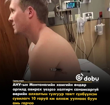 Өөрийн алхалтын таяг биед нь нэвт зоогдсон ч тайван байж уулнаас буусан сувилагчийн гайхамшигт түүх