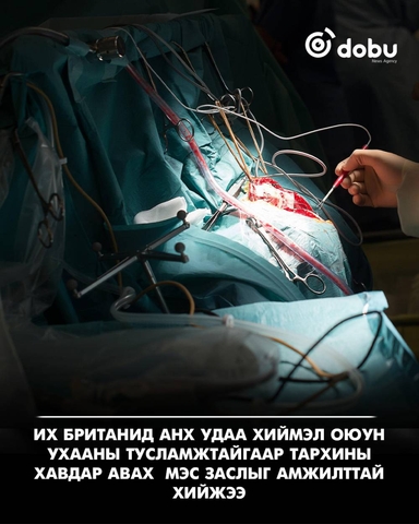 Их Британид хиймэл оюун ухааны тусламжтайгаар тархины хавдар авах дэлхийн анхны мэс заслыг амжилттай хийжээ