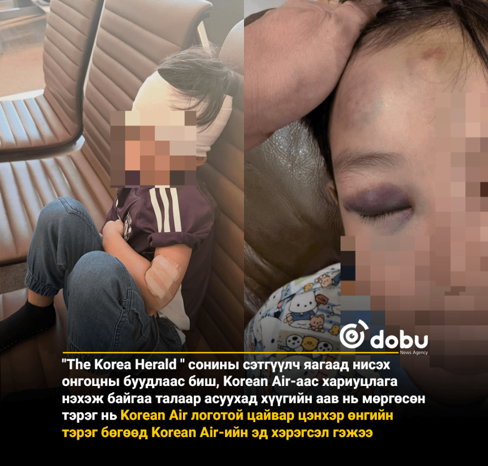 Тэргэнцэр мөргөсөн хүүгийн аав нисэх онгоцны буудал биш Korean Air хариуцлагаа хүлээх ёстой гэжээ