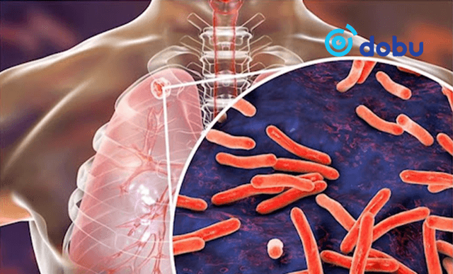 Эмэнд тэсвэртэй сүрьегийн улмаас манай улсад жил бүр 15-20 хүн нас бардаг