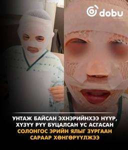 Эхнэрийнхээ нүүр, хүзүүг буцалсан усаар түлсэн эрийн ялыг зургаан сараар хөнгөрүүлэв