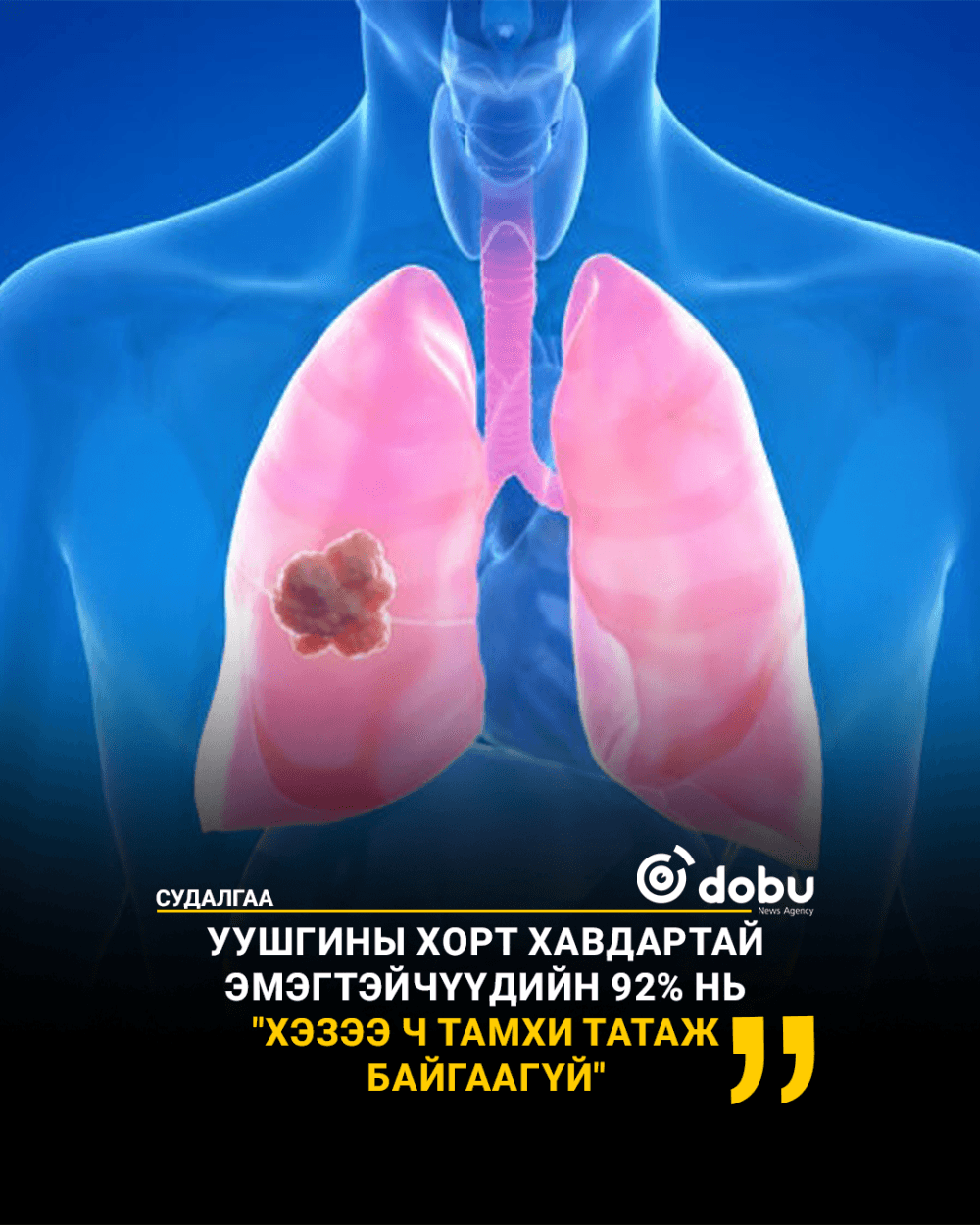 СУДАЛГАА: Уушгины хорт хавдартай эмэгтэйчүүдийн 92% нь "Хэзээ ч тамхи татаж байгаагүй"
