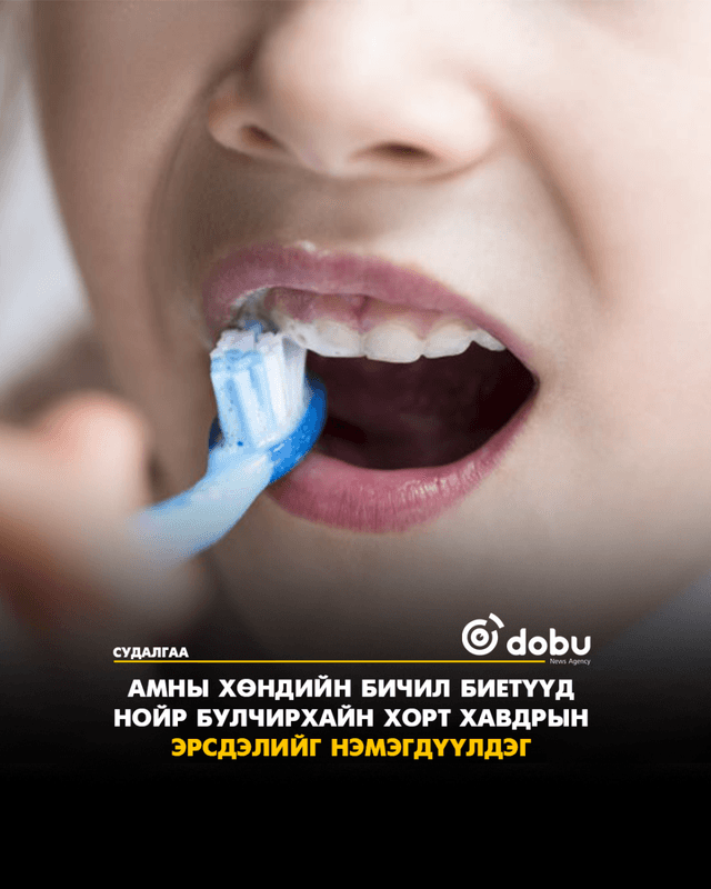 Судалгаа: Aмны хөндийн бичил биетүүд нойр булчирхайн хорт хавдрын эрсдэлийг нэмэгдүүлдэг