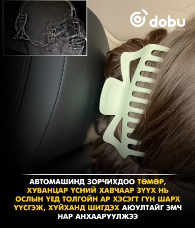Машинд суухдаа үсний хавчаараа авахыг эмч нар анхааруулжээ